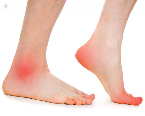 ¿La neuropatía diabética tiene cura?