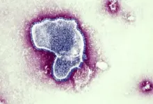 Identifican los tres primeros casos de bronquiolitis por una mutación del VRS que desafía al tratamiento que protege a los bebés
